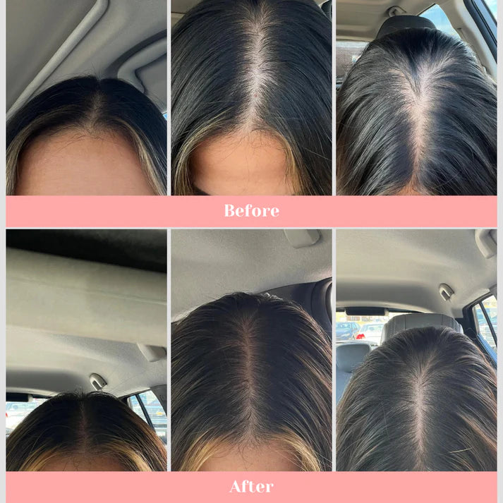 Revitalize Scalp Massager™